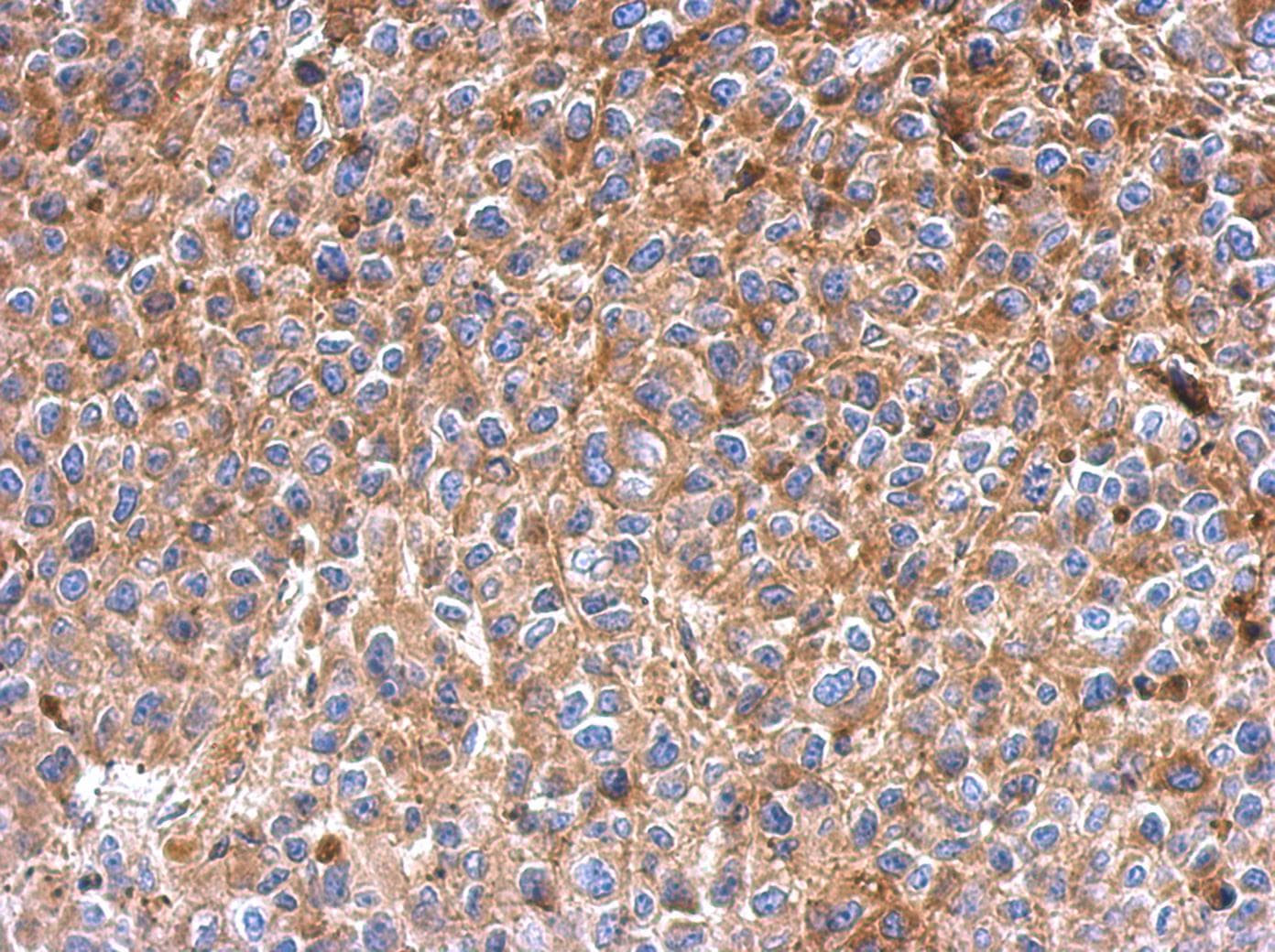 Polyclonal Rabbit anti-Human IFIT3 Antibody (aa230-490, IHC, WB)