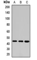 Polyclonal Rabbit anti-Human ASGR1 / ASGPR Antibody (IHC, WB)