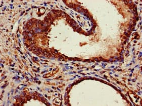 Polyclonal Rabbit anti-Human MRE11A / MRE11 Antibody (IHC, IF)