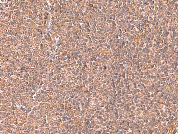 RABEPK / p40 Antibody