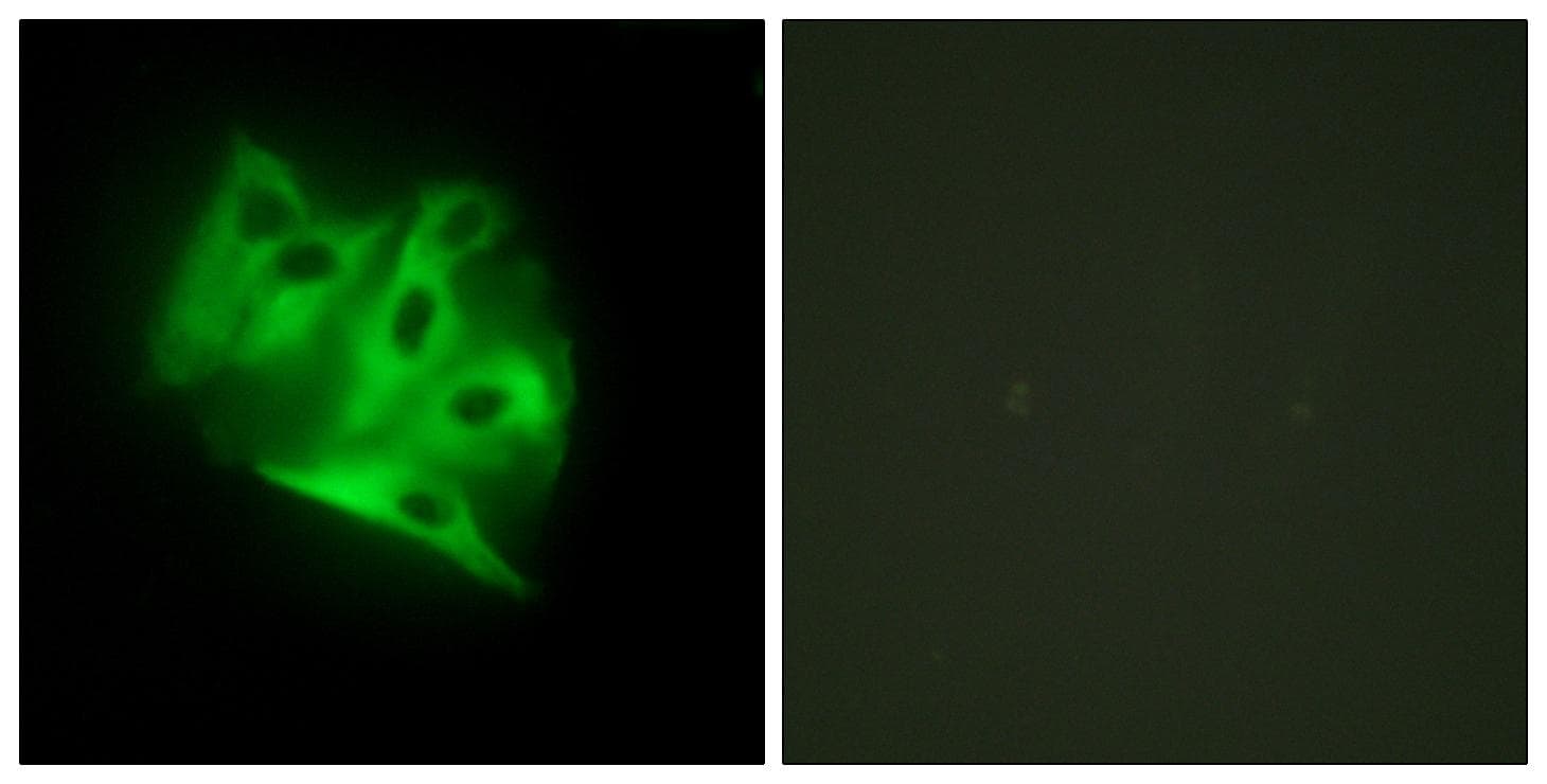Polyclonal Rabbit anti-Human Gravin / AKAP12 Antibody (IHC, IF)