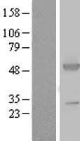 Human ASS1 / ASS Protein (Over-Expression Lysate Myc-DDK (Flag))