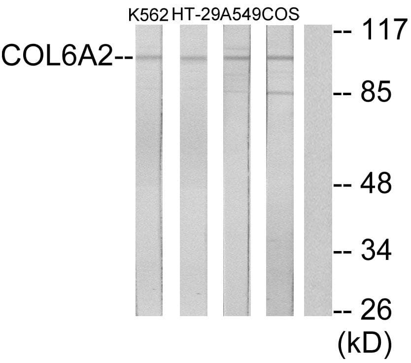 COL6A2 / Collagen VI Alpha 2 Antibody