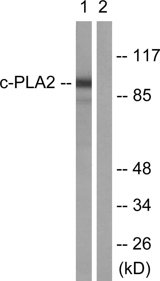 IHC-plus™ Polyclonal Rabbit anti-Human PLA2G4A Antibody (aa471-520, IHC, IF, WB)