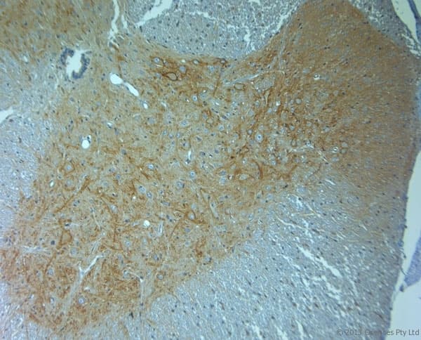 Polyclonal Rabbit anti-Human ACAN / Aggrecan Antibody (aa200-250, IHC)