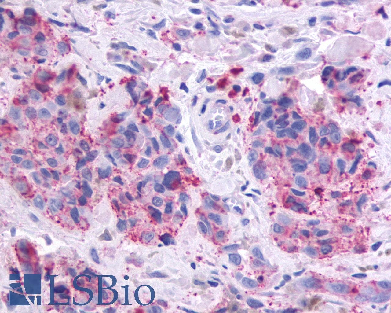 PathPlus™ OR51E1 Antibody (C-Terminus)