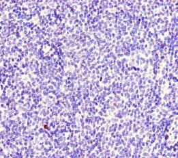MYO1G / HA2 Antibody