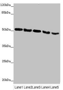 Polyclonal Rabbit anti-Human INPP5K / SKIP Antibody (IHC, WB)