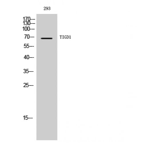 EEYORE / TIGD1 Antibody (220-300 aa, Internal)