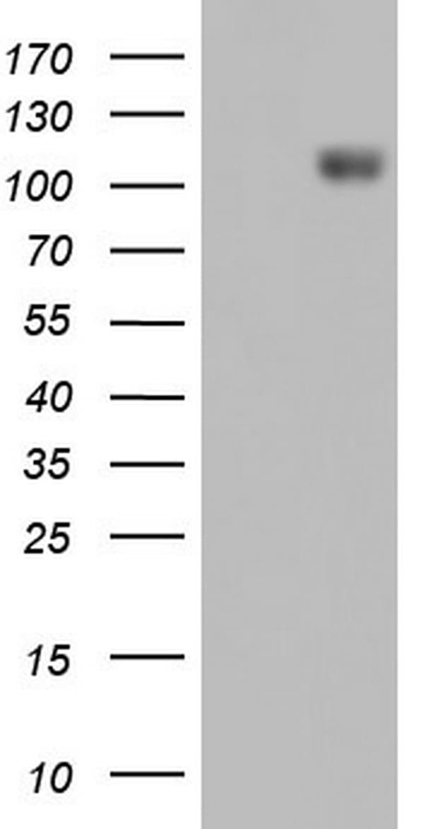 IFIH1 / MDA5 Antibody (clone OTI3E10)