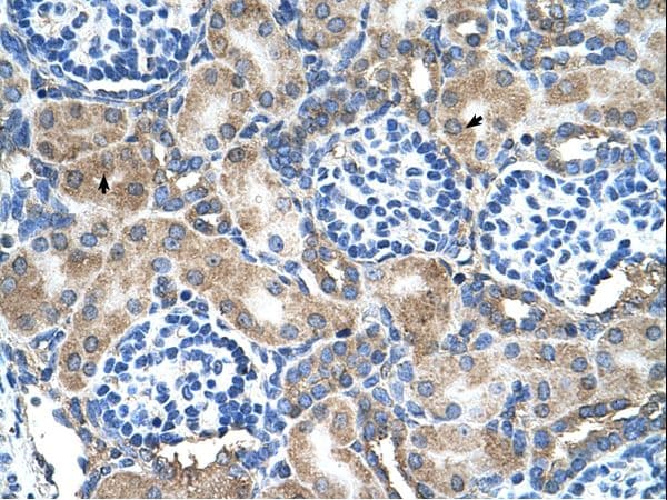 SOD1 / Cu-Zn SOD Antibody (N-Terminus, Biotin)
