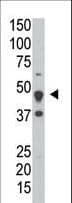 DUSP6 / MKP3 Antibody (aa58-89)