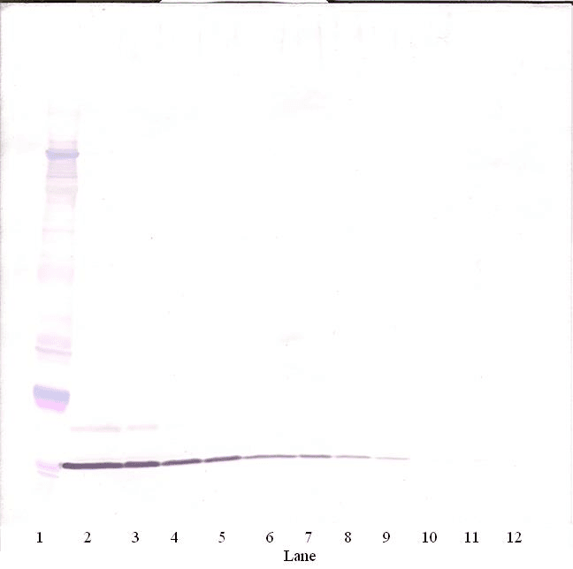IHC-plus™ Monoclonal Mouse anti-Human CCL20 / MIP-3-Alpha Antibody (IHC, WB)