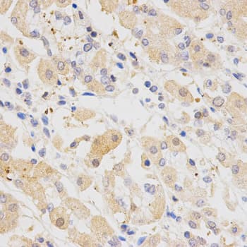 Polyclonal Rabbit anti-Human SH2B1 Antibody (IHC, IF, WB)