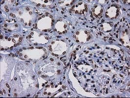 CTDSP1 / SCP1 Antibody (clone OTI1B6)