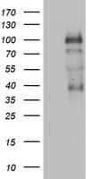 Monoclonal Mouse anti-Human PR / Progesterone Receptor Antibody (clone OTI2E2, aa1-298, IHC, WB)