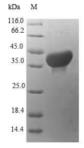 Human BCMP84 / S100A14 Protein (Recombinant GST, N-terminus)