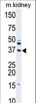 DGUOK / Deoxyguanosine Kinase Antibody (aa1-30)