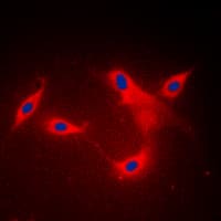LYPLA1 Antibody (Internal)