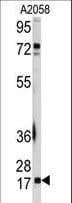 Polyclonal Rabbit anti-Human UBE2I / UBC9 Antibody (aa1-30, IHC, WB)