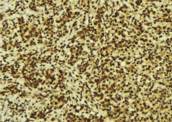 TFB1 / GTF2H1 Antibody