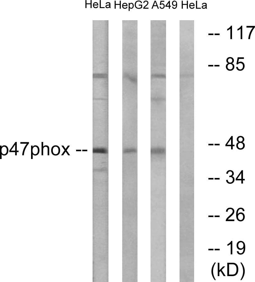NCF1 / p47phox / p47 phox Antibody (p370)