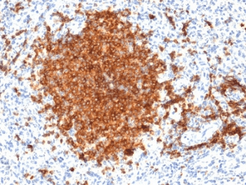 Monoclonal Mouse anti-Human CD22 Antibody (clone BLCAM/1795, IHC, WB)