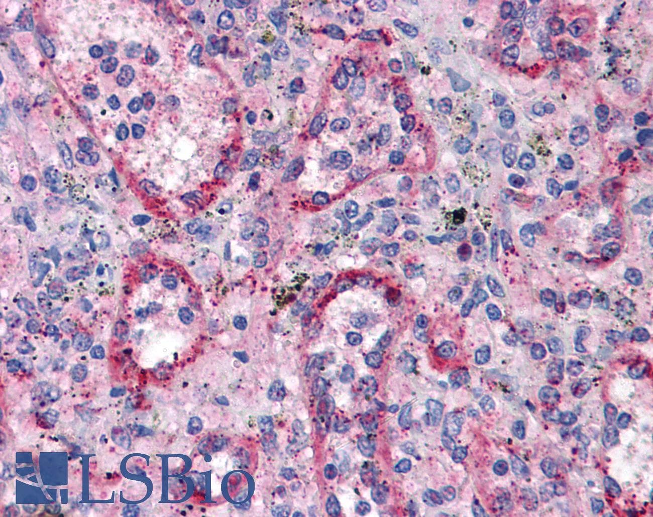 IHC-plus™ VTCN1 / B7-H4 Antibody (clone H74)