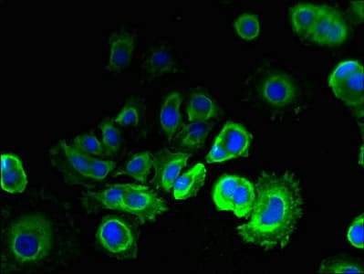 TMEM93 Antibody