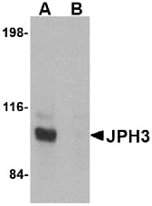 IHC-plus™ Polyclonal Rabbit anti-Human JPH3 Antibody (IHC, IF, WB)