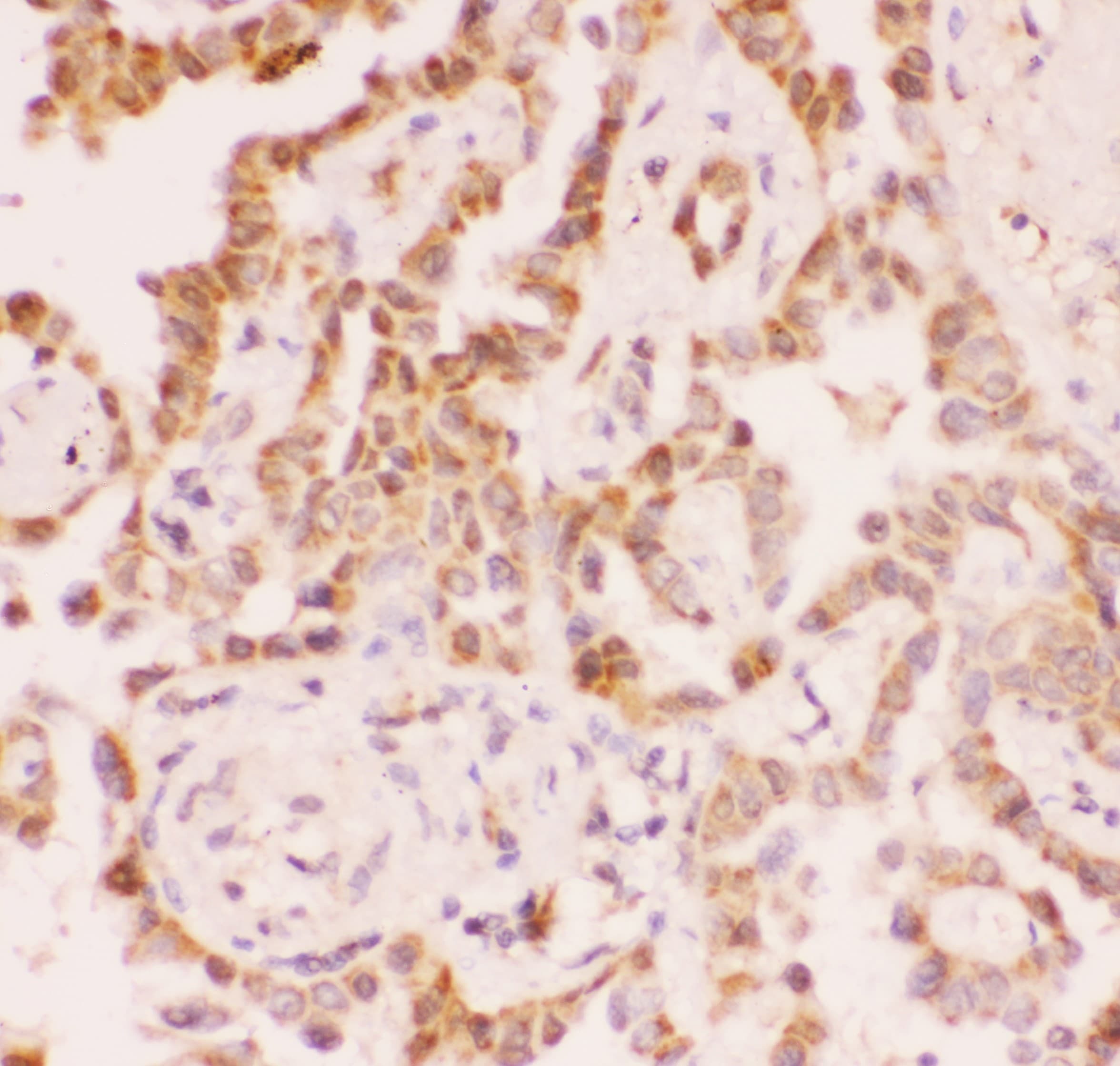SIRT2 / Sirtuin 2 Antibody (aa165-187)