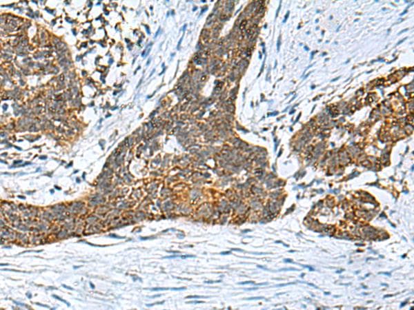PREPL Antibody
