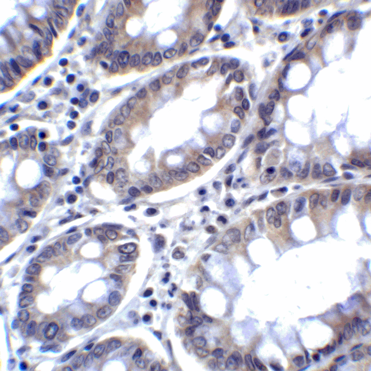 IHC-plus™ PD-L2 / PDCD1LG2 / CD273 Antibody (clone 8C12)