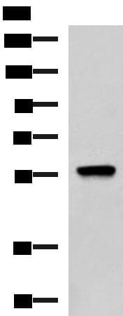 TRF1 / TERF1 Antibody
