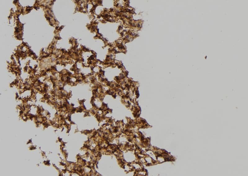 SH3GLB2 / Endophilin-B2 Antibody