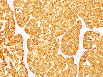 MLANA / Melan-A Antibody (clone M2-7C10 + M2-9E3)