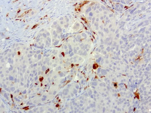 S100A9 / MRP14 Antibody (clone UMAB174, Carrier-free)