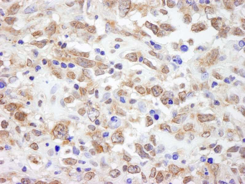 Polyclonal Rabbit anti-Human NRSF / REST Antibody (aa1050-C-term, IHC, WB)