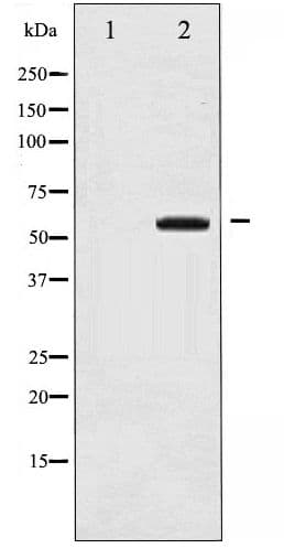 MAP3K8 / TPL2 Antibody (phospho-Thr290)