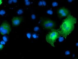 MAPK7 / ERK5 Antibody (clone OTI1G1)