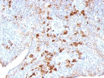 Monoclonal Mouse Anti-Human Lambda Light Chain Secondary Antibody (clone LAM03, IHC, IF)