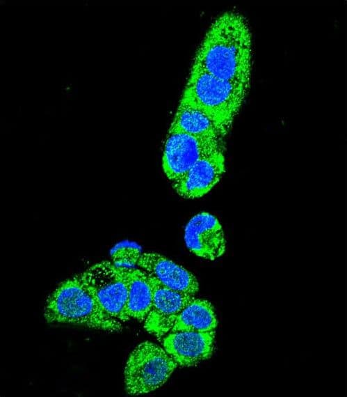 Polyclonal Rabbit anti-Human FAH Antibody (aa7-33, IHC, IF, WB)