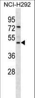 PathPlus™ GP2 Antibody (aa55-84)