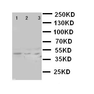 MAPK13 / p38delta Antibody (aa343-360)