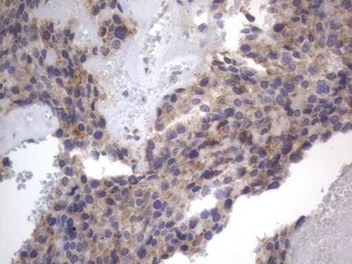DDOST / OST48 Antibody (aa131-378, clone OTI2B4)