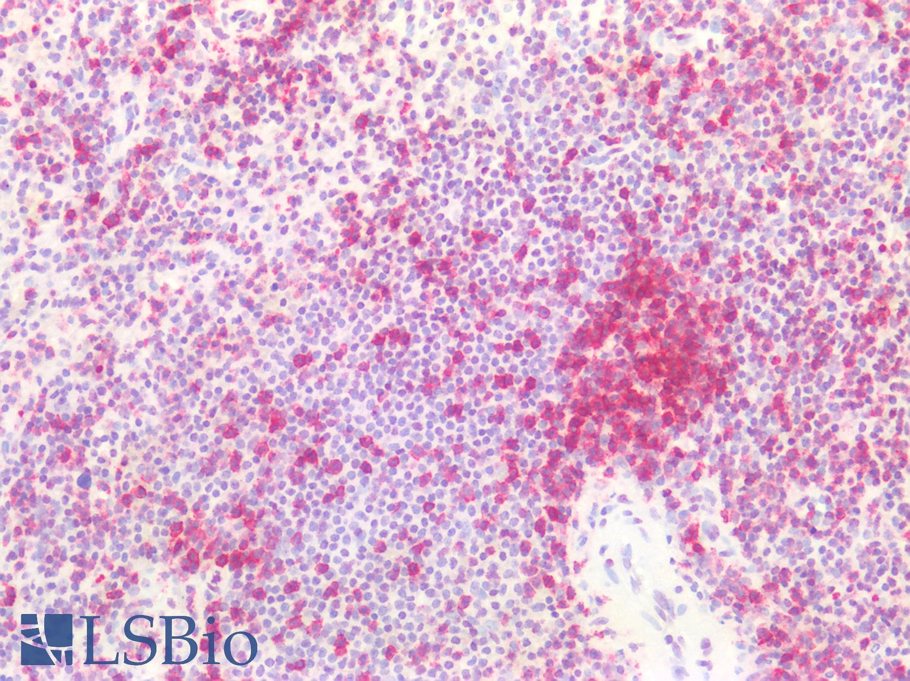 PathPlus™ CD45RO Antibody (clone UCHL-1)