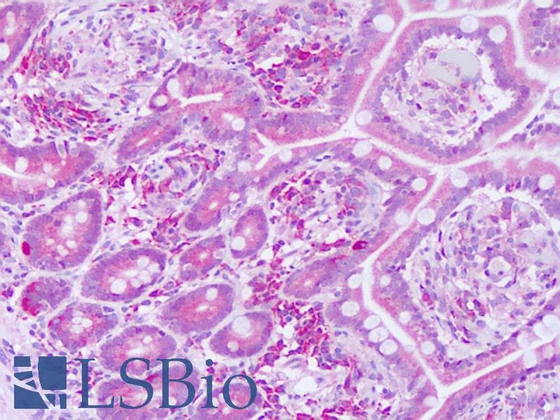Polyclonal Rabbit anti-Human KTI12 Antibody (aa170-219, IHC, WB)