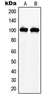 Polyclonal Rabbit anti-Human NARG1 / NAA15 Antibody (Internal, IHC, IF, WB)