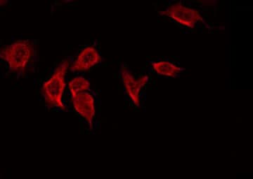 Polyclonal Rabbit anti-Human MMP7 / Matrilysin Antibody (IHC, IF, WB)