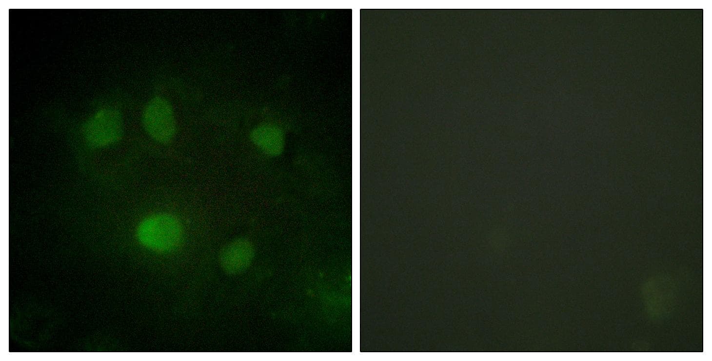 DDX5 Antibody